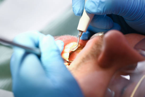 Best Pediatric Emergency Dentist in Island City, OR